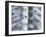 Skeleton spine and ribs-Robert Llewellyn-Framed Premium Photographic Print