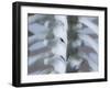 Skeleton spine and ribs-Robert Llewellyn-Framed Premium Photographic Print