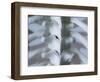 Skeleton spine and ribs-Robert Llewellyn-Framed Photographic Print