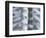 Skeleton spine and ribs-Robert Llewellyn-Framed Photographic Print
