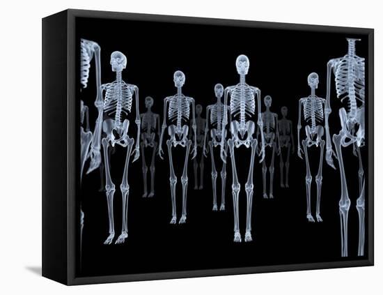 Skeletons, X-ray Artwork-David Mack-Framed Stretched Canvas