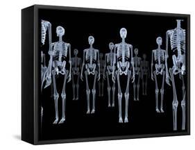 Skeletons, X-ray Artwork-David Mack-Framed Stretched Canvas