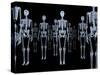 Skeletons, X-ray Artwork-David Mack-Stretched Canvas