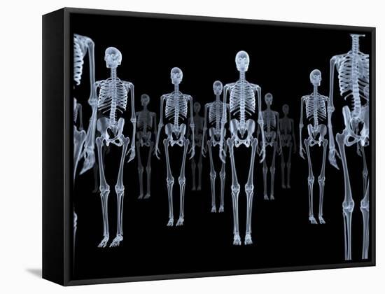 Skeletons, X-ray Artwork-David Mack-Framed Stretched Canvas