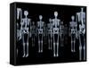 Skeletons, X-ray Artwork-David Mack-Framed Stretched Canvas