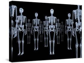 Skeletons, X-ray Artwork-David Mack-Stretched Canvas
