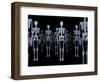 Skeletons, X-ray Artwork-David Mack-Framed Premium Photographic Print