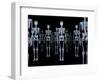 Skeletons, X-ray Artwork-David Mack-Framed Premium Photographic Print