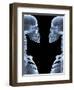 Skeletons, X-ray Artwork-David Mack-Framed Premium Photographic Print