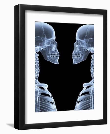 Skeletons, X-ray Artwork-David Mack-Framed Premium Photographic Print