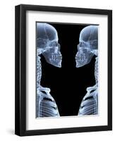 Skeletons, X-ray Artwork-David Mack-Framed Premium Photographic Print