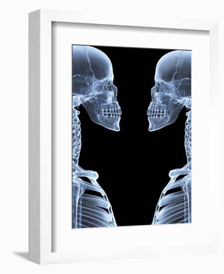 Skeletons, X-ray Artwork-David Mack-Framed Premium Photographic Print