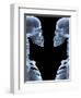 Skeletons, X-ray Artwork-David Mack-Framed Premium Photographic Print