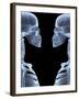 Skeletons, X-ray Artwork-David Mack-Framed Premium Photographic Print