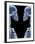 Skeletons, X-ray Artwork-David Mack-Framed Premium Photographic Print