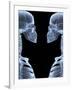 Skeletons, X-ray Artwork-David Mack-Framed Photographic Print