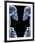 Skeletons, X-ray Artwork-David Mack-Framed Photographic Print