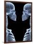 Skeletons, X-ray Artwork-David Mack-Framed Photographic Print