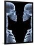 Skeletons, X-ray Artwork-David Mack-Framed Photographic Print