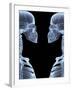 Skeletons, X-ray Artwork-David Mack-Framed Photographic Print