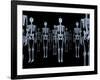 Skeletons, X-ray Artwork-David Mack-Framed Photographic Print