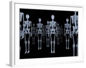 Skeletons, X-ray Artwork-David Mack-Framed Photographic Print