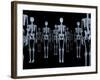 Skeletons, X-ray Artwork-David Mack-Framed Photographic Print