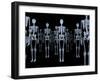 Skeletons, X-ray Artwork-David Mack-Framed Photographic Print