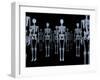 Skeletons, X-ray Artwork-David Mack-Framed Photographic Print