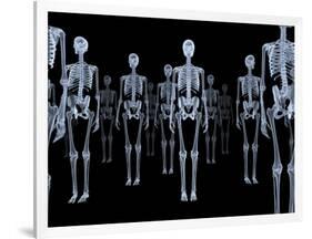 Skeletons, X-ray Artwork-David Mack-Framed Photographic Print