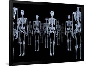 Skeletons, X-ray Artwork-David Mack-Framed Photographic Print