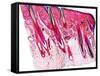 Skin Section, Light Micrograph-Dr. Keith Wheeler-Framed Stretched Canvas