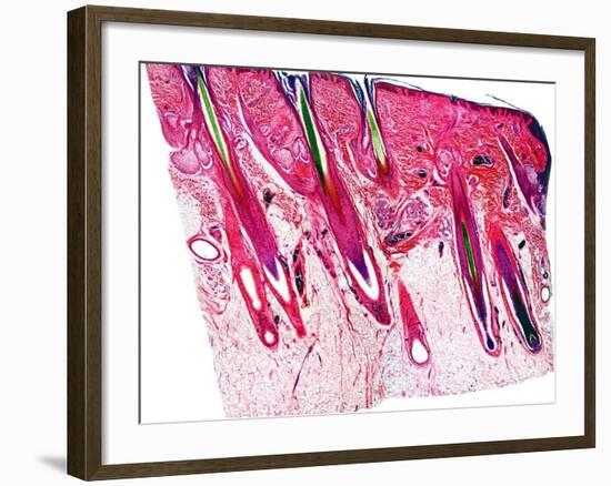 Skin Section, Light Micrograph-Dr. Keith Wheeler-Framed Photographic Print