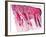 Skin Section, Light Micrograph-Dr. Keith Wheeler-Framed Photographic Print