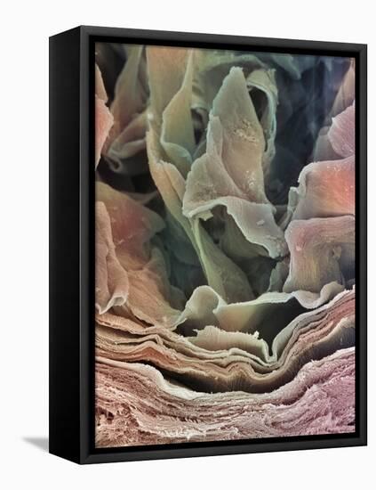 Skin Surface, SEM-Steve Gschmeissner-Framed Stretched Canvas