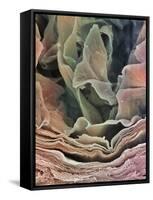 Skin Surface, SEM-Steve Gschmeissner-Framed Stretched Canvas