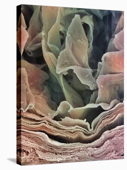 Skin Surface, SEM-Steve Gschmeissner-Stretched Canvas