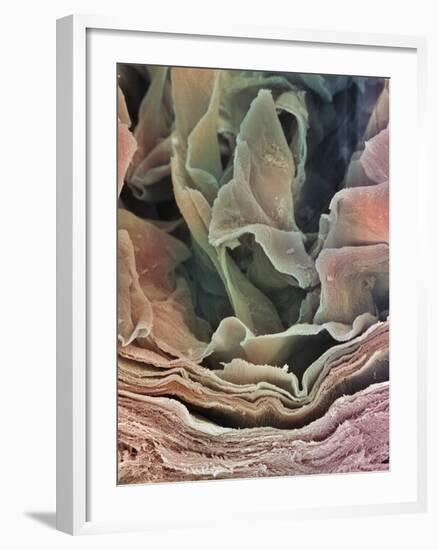 Skin Surface, SEM-Steve Gschmeissner-Framed Photographic Print