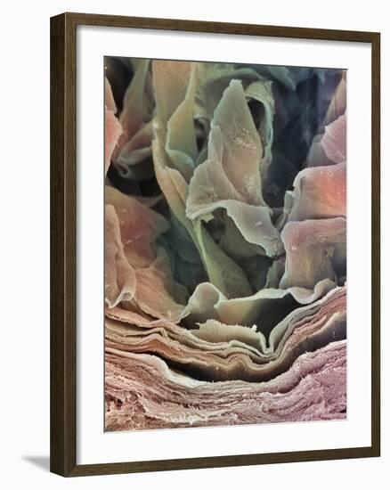 Skin Surface, SEM-Steve Gschmeissner-Framed Photographic Print