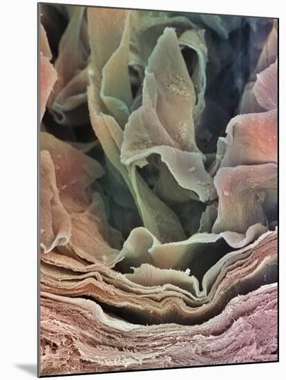 Skin Surface, SEM-Steve Gschmeissner-Mounted Photographic Print