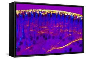 Skin Sweat Glands, Light Micrograph-Dr. Keith Wheeler-Framed Stretched Canvas