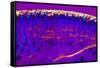 Skin Sweat Glands, Light Micrograph-Dr. Keith Wheeler-Framed Stretched Canvas