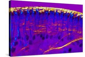 Skin Sweat Glands, Light Micrograph-Dr. Keith Wheeler-Stretched Canvas