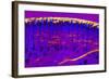 Skin Sweat Glands, Light Micrograph-Dr. Keith Wheeler-Framed Premium Photographic Print