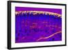 Skin Sweat Glands, Light Micrograph-Dr. Keith Wheeler-Framed Premium Photographic Print