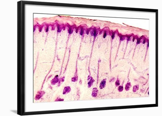 Skin Sweat Glands, Light Micrograph-Dr. Keith Wheeler-Framed Photographic Print