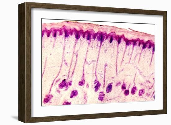 Skin Sweat Glands, Light Micrograph-Dr. Keith Wheeler-Framed Photographic Print