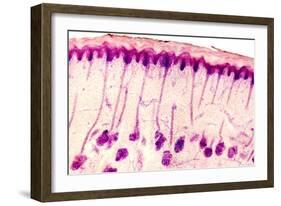 Skin Sweat Glands, Light Micrograph-Dr. Keith Wheeler-Framed Photographic Print