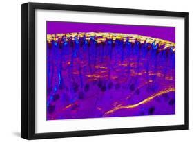 Skin Sweat Glands, Light Micrograph-Dr. Keith Wheeler-Framed Photographic Print