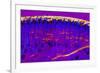 Skin Sweat Glands, Light Micrograph-Dr. Keith Wheeler-Framed Photographic Print